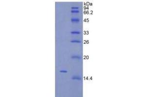 SDS-PAGE analysis of Rat TSLP Protein. (Thymic Stromal Lymphopoietin Protein (TSLP))