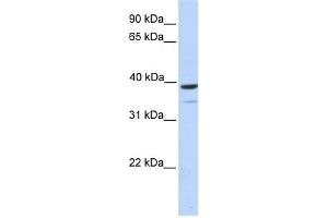 WB Suggested Anti-TRIM27 Antibody Titration:  0.