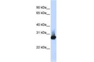 Image no. 1 for anti-B-Cell Receptor-Associated Protein 31 (BCAP31) (C-Term) antibody (ABIN6749735) (BCAP31 antibody  (C-Term))