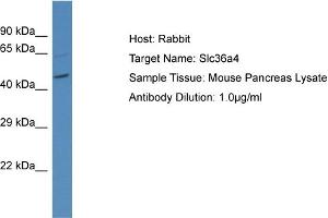 Host: Rabbit Target Name: SLC36A4 Sample Tissue: Mouse Pancreas Antibody Dilution: 1ug/ml