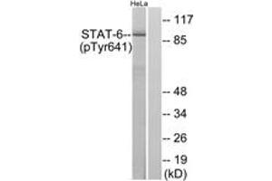 Western blot analysis of extracts from HeLa cells treated with IL-4, using STAT6 (Phospho-Tyr641) Antibody.