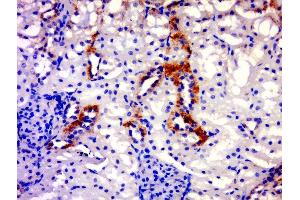 IGSF21 antibody  (AA 90-140)