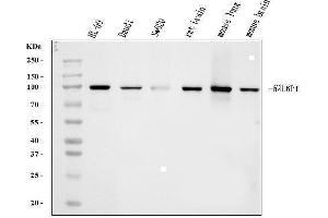 Western blot analysis of RALBP1 using anti-RALBP1 antibody (ABIN7600800).