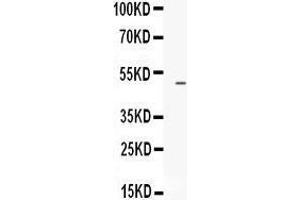 Observed bind size: 50KD (EDNRB antibody  (C-Term))