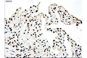 Immunohistochemical staining of paraffin-embedded colon tissue using anti-SSBmouse monoclonal antibody. (SSB antibody)