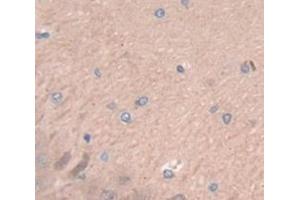 Figure. (WISP2 antibody  (AA 15-250))