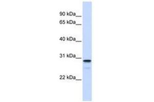 Image no. 1 for anti-Family with Sequence Similarity 78, Member B (FAM78B) (AA 144-193) antibody (ABIN6741116)