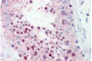 Anti-SLITRK6 antibody  ABIN960818 IHC staining of human testis. (SLITRK6 antibody  (Cytoplasmic Domain))