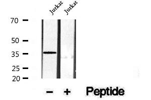 Western blot analysis of extracts of Jurkat cells, using Phospho-CDK6(Tyr292) Antibody.