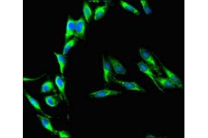 Immunofluorescent analysis of Hela cells using ABIN7158234 at dilution of 1:100 and Alexa Fluor 488-congugated AffiniPure Goat Anti-Rabbit IgG(H+L) (CD37 antibody  (AA 109-237))