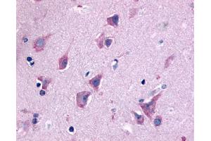 Anti-QRFPR / GPR103 antibody IHC of human brain, neurons and glia. (QRFPR antibody  (N-Term))