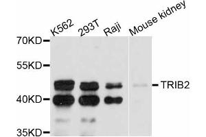Western blot analysis of extracts of various cell lines, using TRIB2 antibody (ABIN4905491) at 1:3000 dilution. (TRIB2 antibody)