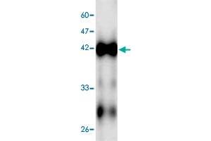 Western blot analysis in ECs2841 recombinant protein with ECs2841 monoclonal antibody, clone 5f4s6  at 1 : 1000 dilution. (ECs2841 antibody  (AA 23-338))