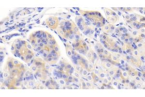 Detection of PIGR in Mouse Stomach Tissue using Polyclonal Antibody to Polymeric Immunoglobulin Receptor (PIGR) (PIGR antibody  (AA 135-237))