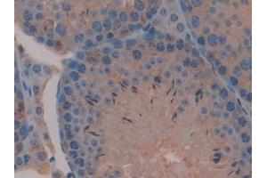 Immunohistochemistry (IHC) image for anti-Mitogen-Activated Protein Kinase Kinase 2 (MAP2K2) (AA 44-313) antibody (ABIN7439504)