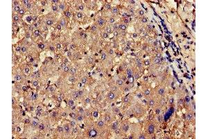 Immunohistochemistry of paraffin-embedded human liver tissue using ABIN7148445 at dilution of 1:100 (CNKSR2 antibody  (AA 650-800))