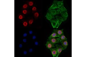 ABIN7094548 and ABIN7098597 staining Hela cells by IF/ICC.