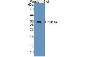 Western blot analysis of recombinant Rat SHP.