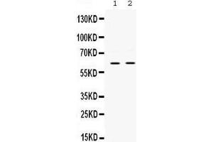 Western blot analysis of PAK3 expression in rat brain extract (lane 1) and mouse brain extract (lane 2). (PAK3 antibody  (N-Term))
