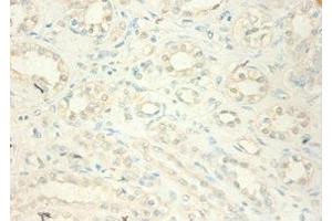 Immunohistochemistry of paraffin-embedded human kidney tissue using ABIN7159541 at dilution of 1:100 (MT2A antibody  (AA 1-59))