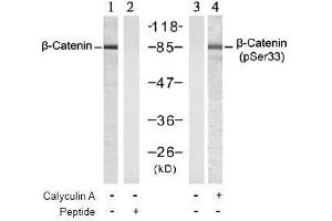 Image no. 3 for anti-Catenin (Cadherin-Associated Protein), beta 1, 88kDa (CTNNB1) (pSer33) antibody (ABIN196956) (CTNNB1 antibody  (pSer33))