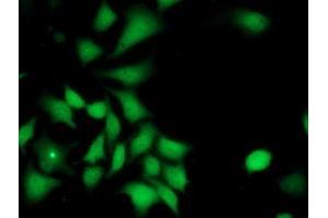 Immunofluorescent staining of HeLa cells using anti-ILVBL mouse monoclonal antibody (ABIN2454750). (ILVBL antibody)