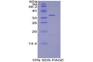 SDS-PAGE (SDS) image for Defensin beta 2 (BD-2) (AA 23-63) protein (His tag,GST tag) (ABIN2122738)