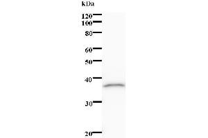 Western Blotting (WB) image for anti-ALX Homeobox 1 (ALX1) antibody (ABIN931200)