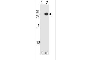 Western blot analysis of RCAN1 using rabbit polyclonal RCAN1 Antibody using 293 cell lysates (2 ug/lane) either nontransfected (Lane 1) or transiently transfected (Lane 2) with the RCAN1 gene. (RCAN1 antibody  (N-Term))