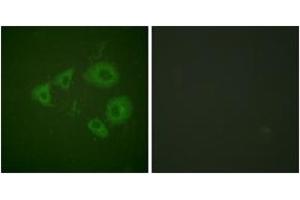 Immunofluorescence analysis of HuvEc cells, using Trk B (Phospho-Tyr705) Antibody.