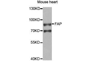 Western blot analysis of extracts of Mouse heart cell line, using FAP antibody. (FAP antibody)