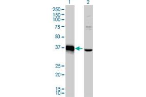 Western Blot analysis of MEOX2 expression in transfected 293T cell line by MEOX2 monoclonal antibody (M03), clone 6A5. (MEOX2 antibody  (AA 1-303))