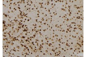 ABIN6277122 at 1/100 staining Mouse brain tissue by IHC-P. (NUMBL antibody  (C-Term))