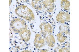 Immunohistochemistry of paraffin-embedded Human stomach using FBXL5 Polyclonal Antibody at dilution of 1:100 (40x lens). (FBXL5 antibody)