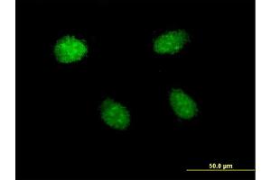 Immunofluorescence of monoclonal antibody to HEY1 on HeLa cell. (HEY1 antibody  (AA 121-220))