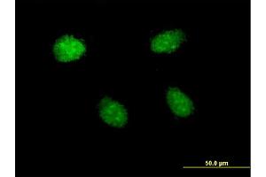 Immunofluorescence of monoclonal antibody to HEY1 on HeLa cell.