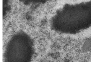 Immunogold labeling of epithelium cells, in vivo injected with RFP expressing vector, (RFP antibody)