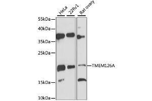 Western blot analysis of extracts of various cell lines, using TMEM126A antibody (ABIN6293944) at 1:3000 dilution. (TMEM126A antibody)