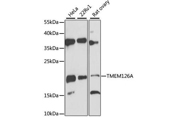 TMEM126A anticorps