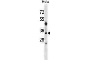 Western blot analysis in Hela cell line lysates (35ug/lane) using LAT2 / WBSCR15  Antibody . (LAT2 antibody  (Middle Region))
