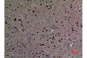 Immunohistochemistry (IHC) analysis of paraffin-embedded Mouse Brain, antibody was diluted at 1:100. (UBE2A/B (C-Term) antibody)