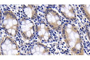 Immunohistochemistry (IHC) image for anti-BCL2-Associated Agonist of Cell Death (BAD) (AA 1-168) antibody (ABIN7443224)