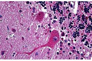 Human Brain, Cerebellum: Formalin-Fixed, Paraffin-Embedded (FFPE) (Huntingtin antibody  (AA 81-191))