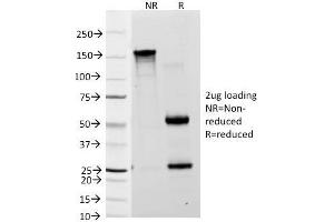 SDS-PAGE Analysis Purified Lewis A Monoclonal Antibody (7LE). (Blood Group Lewis A antibody)