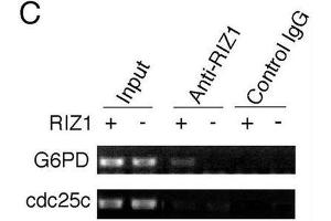 Image no. 3 for anti-PR Domain Containing 2, with ZNF Domain (PRDM2) antibody (ABIN2995299) (PRDM2 antibody)