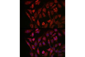 Immunofluorescence (IF) image for anti-Cathepsin B (CTSB) (AA 1-339) antibody (ABIN3021176)