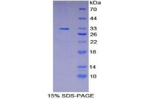 SDS-PAGE (SDS) image for Signal Transducer and Activator of Transcription 2, 113kDa (STAT2) (AA 658-912) protein (His tag) (ABIN1879275)