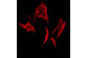 ABIN6276236 staining HuvEc by IF/ICC. (VN1R2 antibody  (Internal Region))