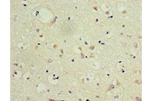 Immunohistochemistry of paraffin-embedded human brain tissue using ABIN7153991 at dilution of 1:100 (GRIN2B antibody  (AA 1185-1484))