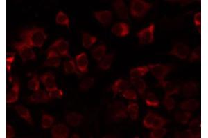 ABIN6274735 staining COLO205 by IF/ICC. (MRPL21 antibody  (Internal Region))